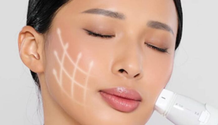 Miracle Aesthetic Clinic Luncurkan Program “Year End Sparkle” untuk Sambut Liburan Akhir Tahun