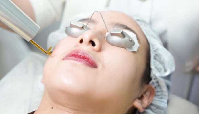 Pendekatan Menyeluruh Miracle Aesthetic Clinic, Tangani Hiperpigmentasi Kulit Pelanggan Indonesia